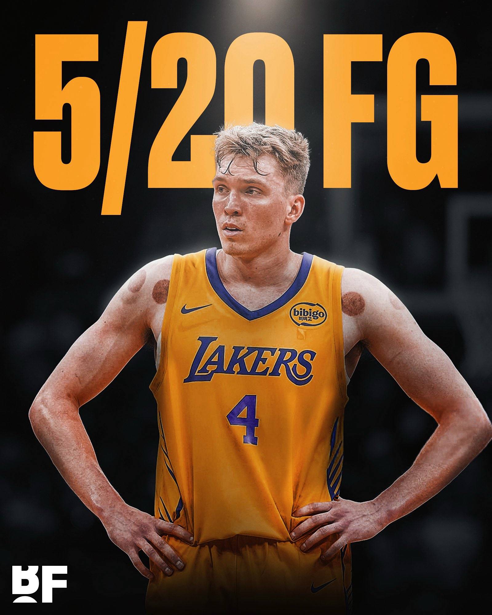 关键时刻洛杉矶湖人备战社区盾，调整名单细节曝光，信心回归，临场指挥获称赞